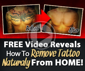  tattoo removal before and after laseraway 