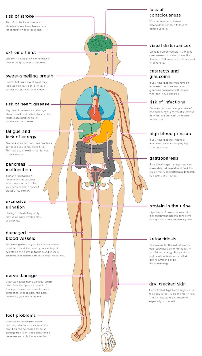 The Effects of Diabetes on Your Body