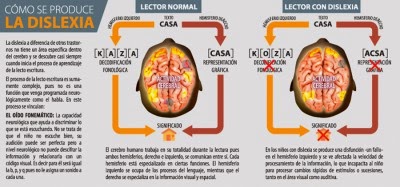 La dislexia, infografía