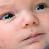 Baby Acne – Common Newborn Ailments - All About Acne