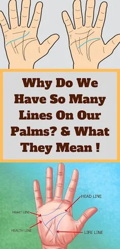 What Does Having Too Many Lines On Palm Indicate?
