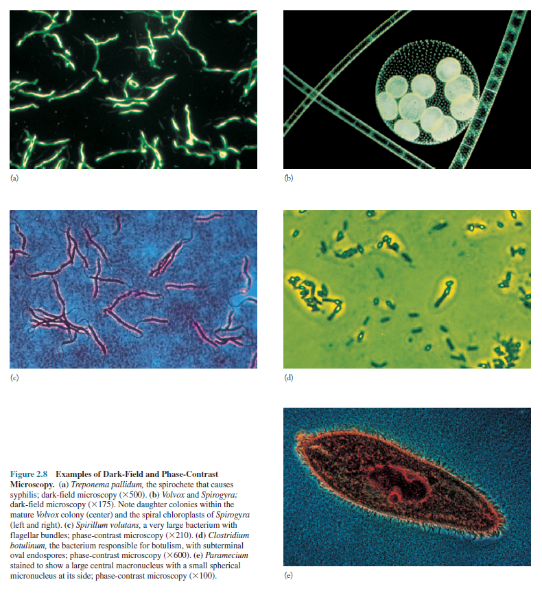 Examples of dark field and phase contrast microscopy