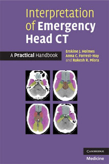 Interpretation of Emergency Head CT: A Practical Handbook