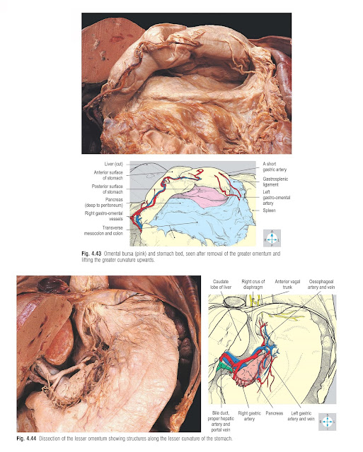 Dissection of the lesser omentum showing structures along the lesser curvature of the stomach.