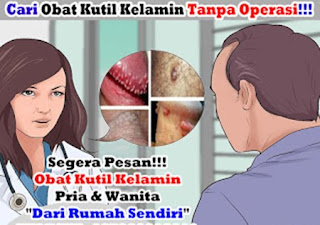 Obat kutil kelamin atau kutil di kemaluan yg mujarap, obat oral untuk kondiloma akuminata, nama salep obat kutil kelamin atau kutil di kemaluan, obat kutil kelamin atau kutil di kemaluan de nature, gambar kutil kelamin pd wanita, mengatasi kutil di kemaluan, kutil pada rambut kelamin, obat kutil kelamin atau kutil di kemaluan yg paling bagus, artikel obat kutil pada kemaluan, salep untuk mengobati kutil kelamin, penyebab kutil kemaluan di anus