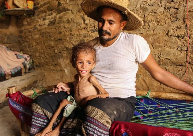 Αναστολή ανθρωπιστικής βοήθειας στην Υεμένη, ελλείψει χρηματοδότησης