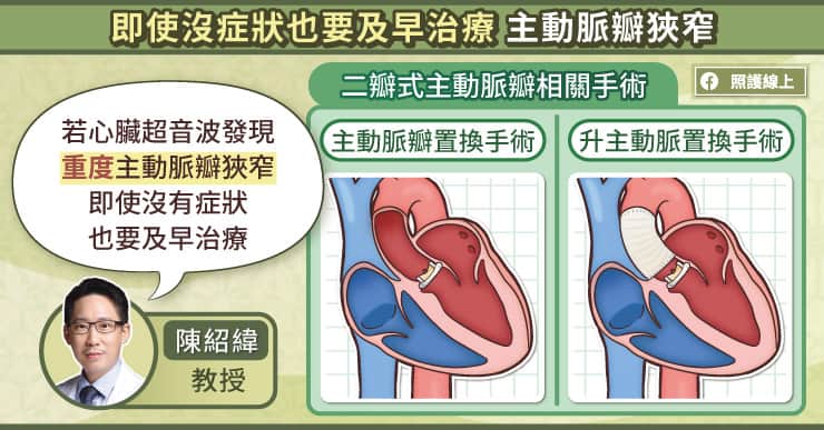 沒有症狀也要及早治療主動脈瓣狹窄