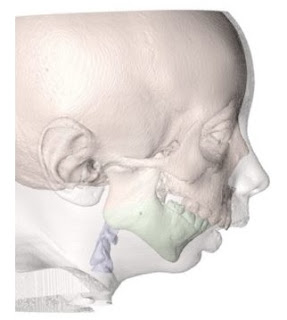 Central Sleep Apnea