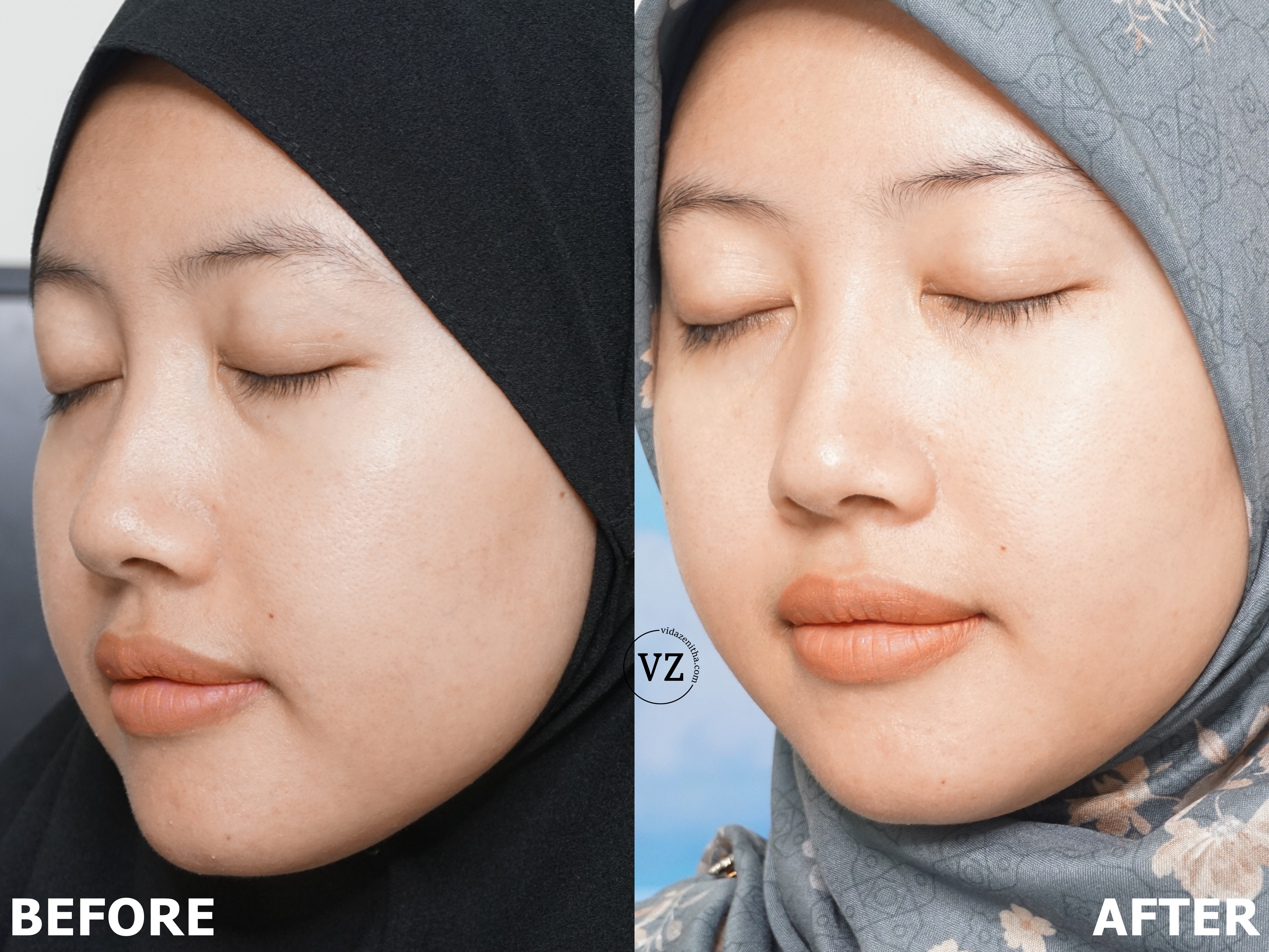 Hasil Pemakaian Scarlett Niacinamide 5% Serum