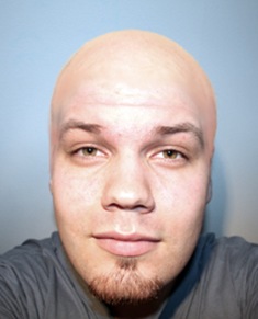 Me_Bald