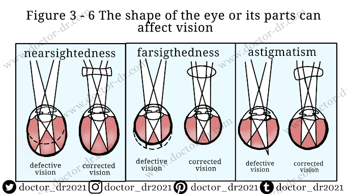 Public Health - Correcting Vision Problems - Eye Checkup - By Microbiology Doctor dr (doctor_dr)