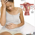 Health Tips: Types, Causes and Symptoms of fibroid