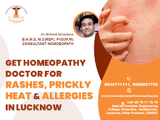 Get Homeopathy Doctor for Rashes, Prickly Heat and Allergies in Lucknow