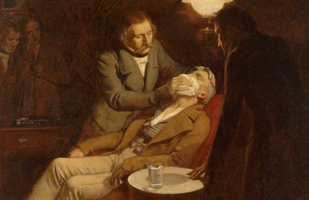 Первое использование эфира, хирургического анестетика в стоматологической хирургии, картина маслом 1846 года Эрнеста Борда.