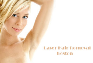 Laser Hair Removal Boston