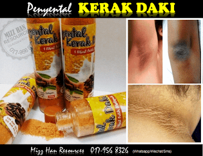 PENYENTAL KERAK DAKI 