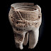 Tooth Cavity Art