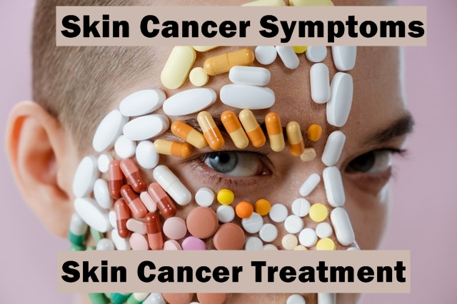 Skin Cancer Symptoms and Skin Cancer Treatment