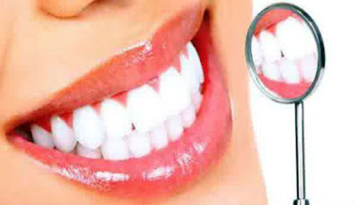 Cara Menghilangkan Flek atau Noda Hitam Pada Gigi