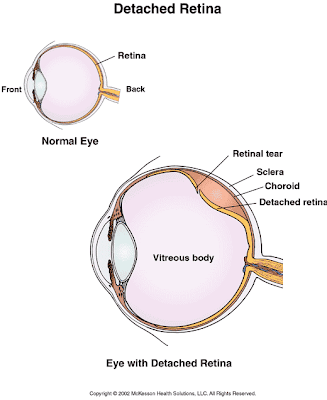 There are three possible paths the surgery can now take.