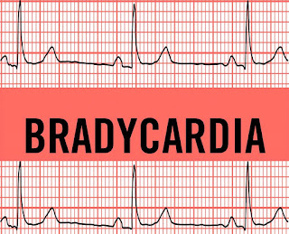 Bradycardia