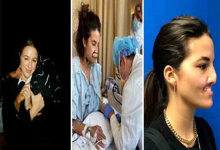 News,National,India,New Delhi,Dog,models,Injured,Health,Health & Fitness,Surgery, 23-year-old model who lost her top lip in pitbull attack in US shares photos after surgeries that reconstructed her beautiful smile