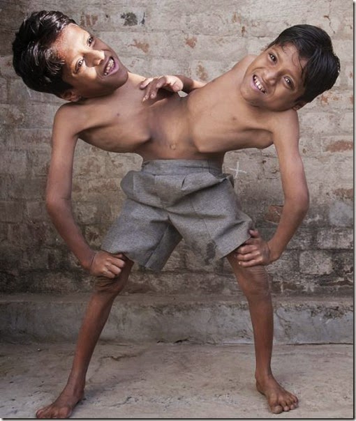 simenses india (1)