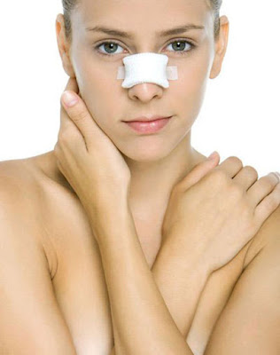 Sửa mũi hỏng sau nâng áp dụng cho những trường hợp không hài lòng với kết quả nâng mũi của mình