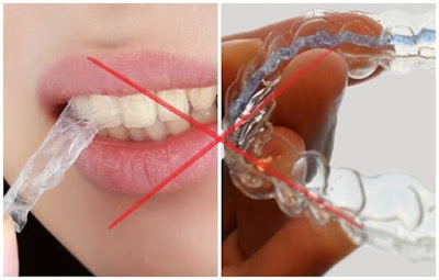 Công nghệ tẩy trắng răng hiệu quả nhất