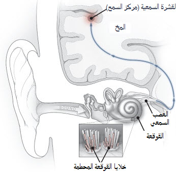 مسار-الصوت