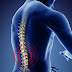 Thoái hóa cột sống gây ra đau lưng