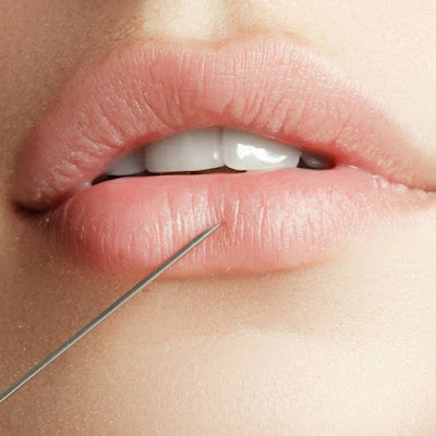Understanding the Anatomy of Lips