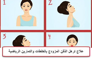 علاج ترهل الجلد تحت الذقن