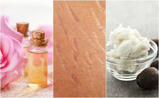 4 Natural Remedy To Make Stretch Marks Less Noticeable  