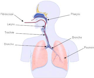 cancer poumons symptomes