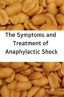 The Symptoms and Treatment of Anaphylactic Shock