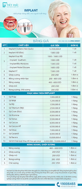 bang-gia-trong-rang-implant