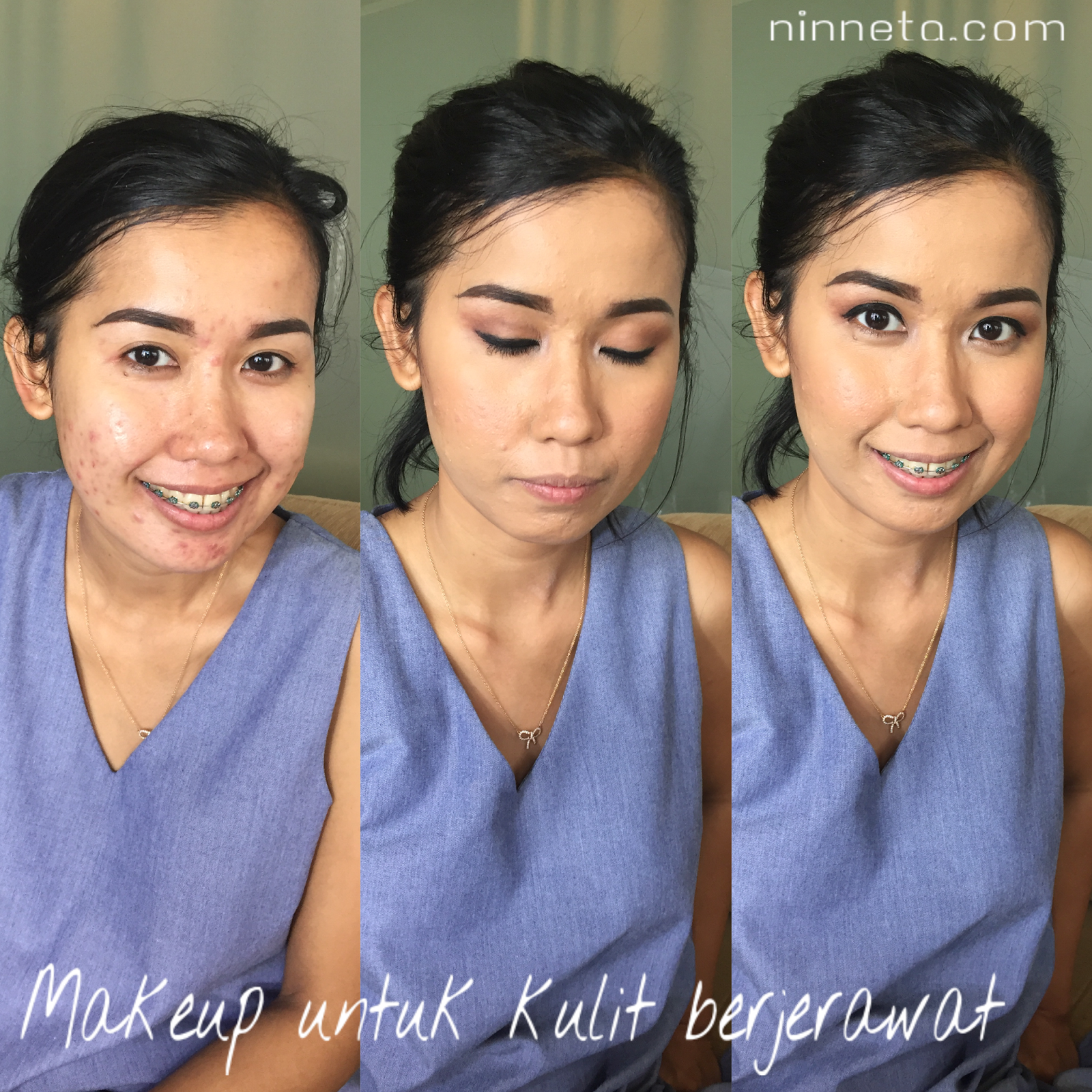 Makeup Untuk Kulit Berjerawat Ninneta