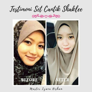 Set kulit cantik shaklee, set kecantikan dalaman, cara putihkan kulit muka, cara cerahkan wajah, hilangkan jerawat, ubat jeragat, kenapa kulit kusam, masalah bintik kolesterol, kulit muka berminyak, rawatan kulit wajah breakout, esp, energizing soy protein, minuman susu soya, turunkan kolesterol, cantikkan kulit, kulit flawles, sebab kulit kusam, pori-pori terbuka, open pores, acne, dark white spot, pigmentasi, kedutan, qiya saad, qiya beauty, siti rokiyah saad, pengedar shaklee bandar putera 2 klang, shaklee klang, shaklee shah alam, shaklee selangor, shaklee jengka maran pahang, shaklee bandar pusat jengka, shaklee uitm jengka pahang, testimoni set kulit cantik shaklee,