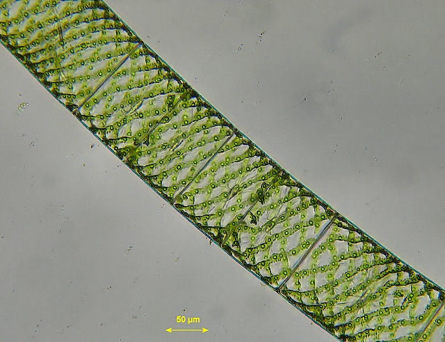 20+ Gambar Spirogyra