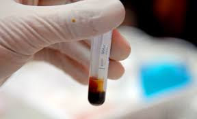 xét nghiệm máu có phát hiện bệnh lậu