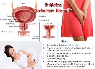 HARGA ANTIBIOTIK INFEKSI SALURAN KEMIH PALING BAGUS DI APOTIK