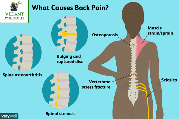 Back Pain Treatment In Thane West