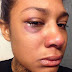 Model Danii Phae shares pics of battered face after attack by rapper bf