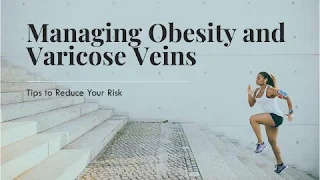 Can Yoga Help Varicose Veins? The Top 5 Poses to Try