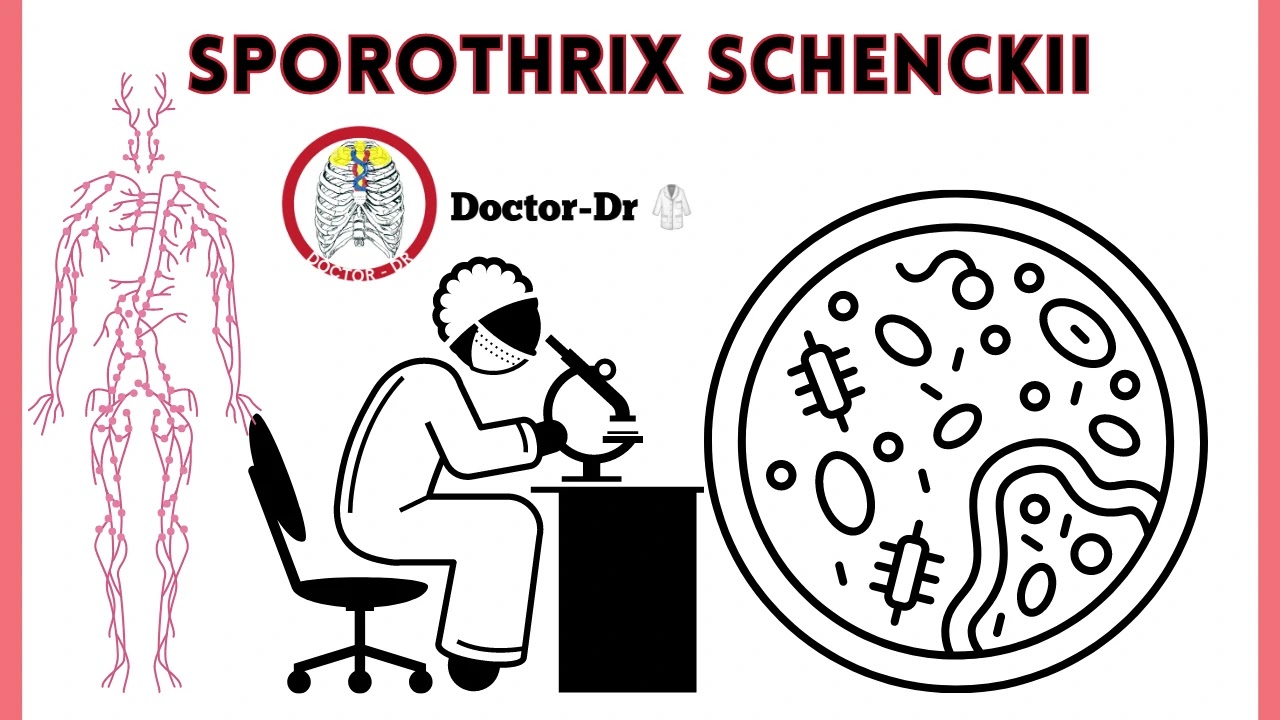 Overview of Sporothrix schenckii