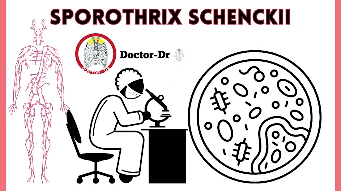 Overview of Sporothrix schenckii