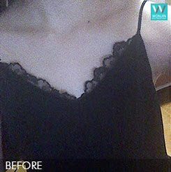 짱이뻐! - Thanks to Korean Celebrities Breast Surgery, Goodbye Padded Bra