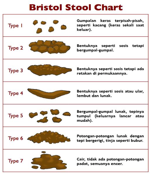 Variasi Warna  dan  Bentuk Tinja Feces Bayi  Kesehatan