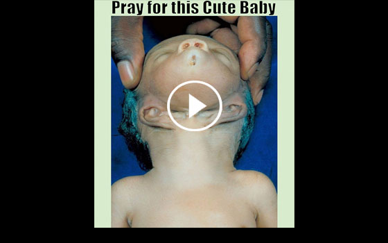 http://elgoog45.blogspot.com/2016/01/see-this-baby-what-happen-with-this-baby.html